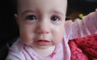 Baby crying with red nose and pale skin